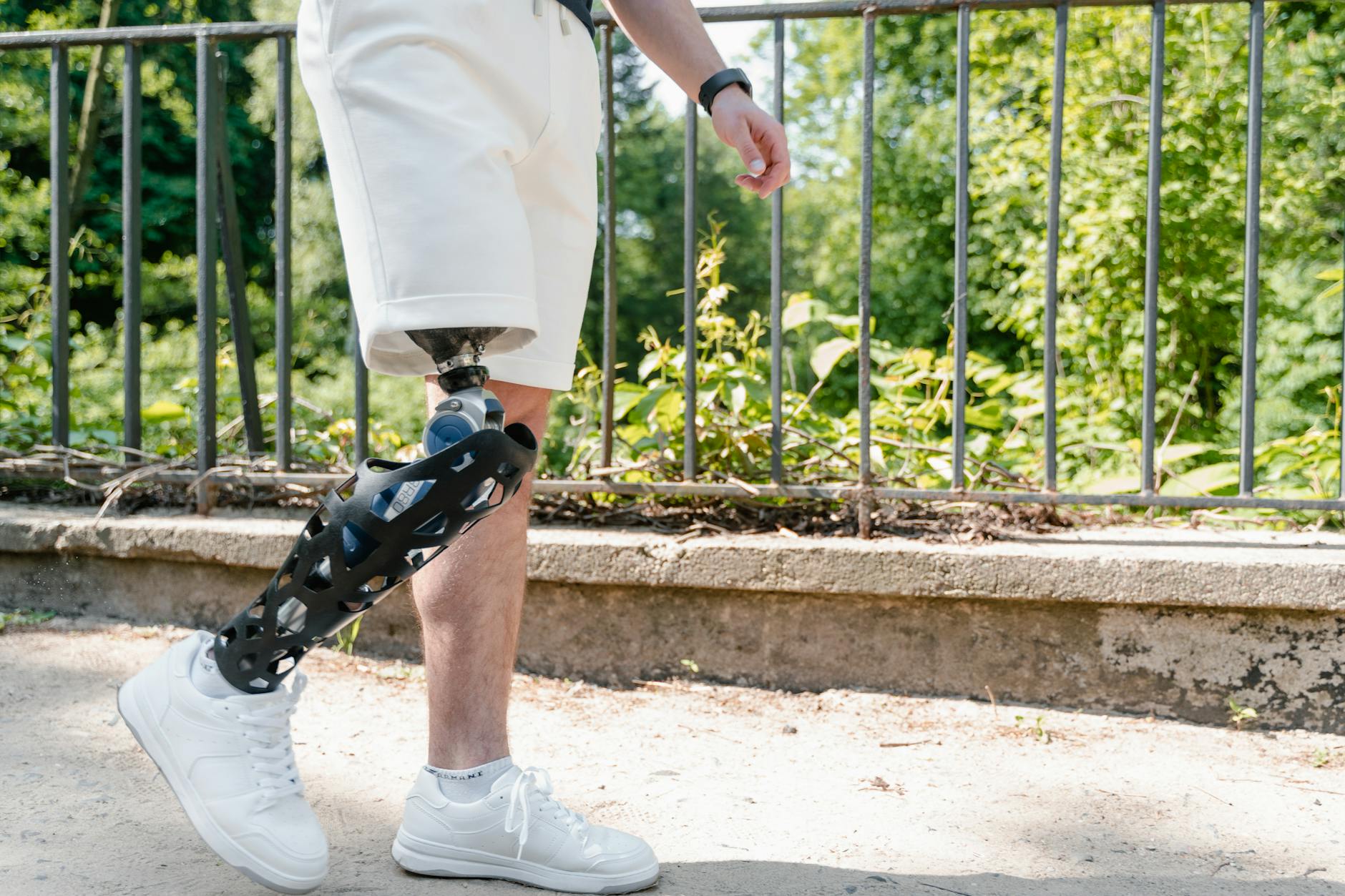 Osoba z nowoczesną protezą nogi spaceruje po parku w białych szortach